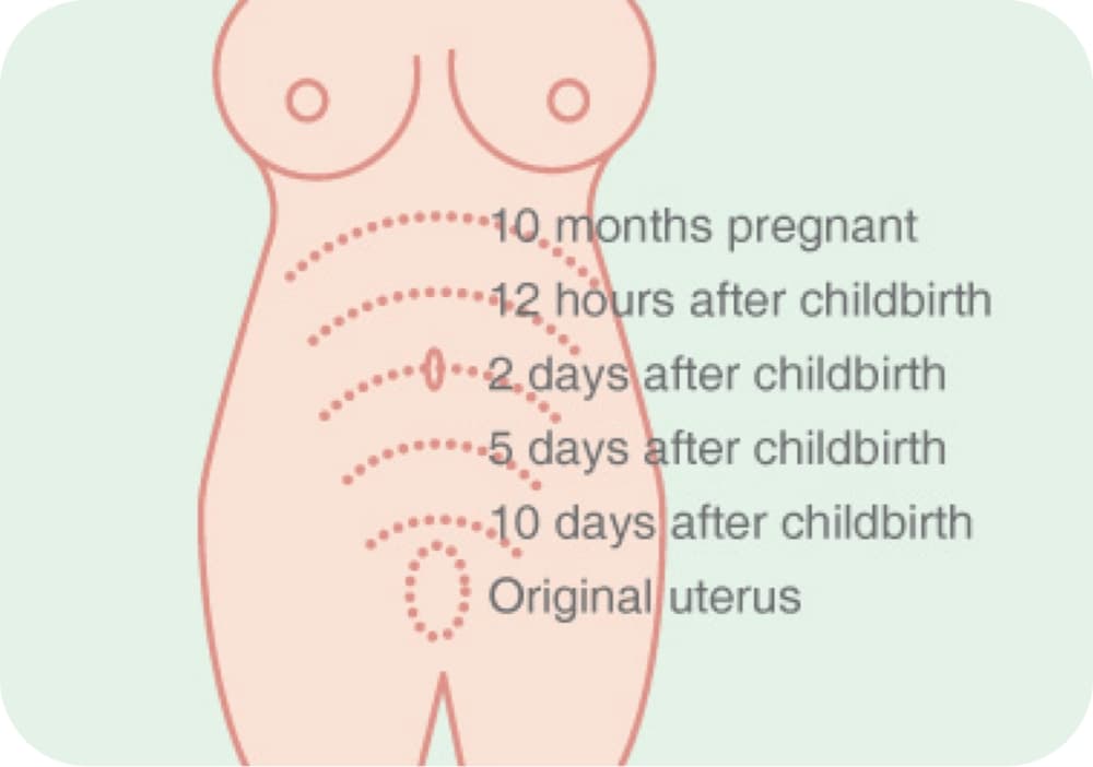 Post Pregnancy Illustration